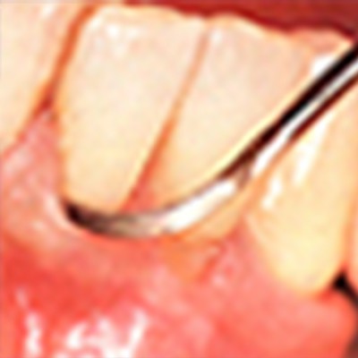 口腔<br>牙周科